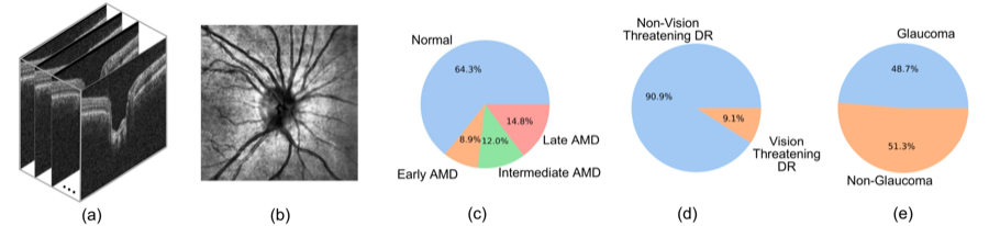 Harvard-FairVision30k preview